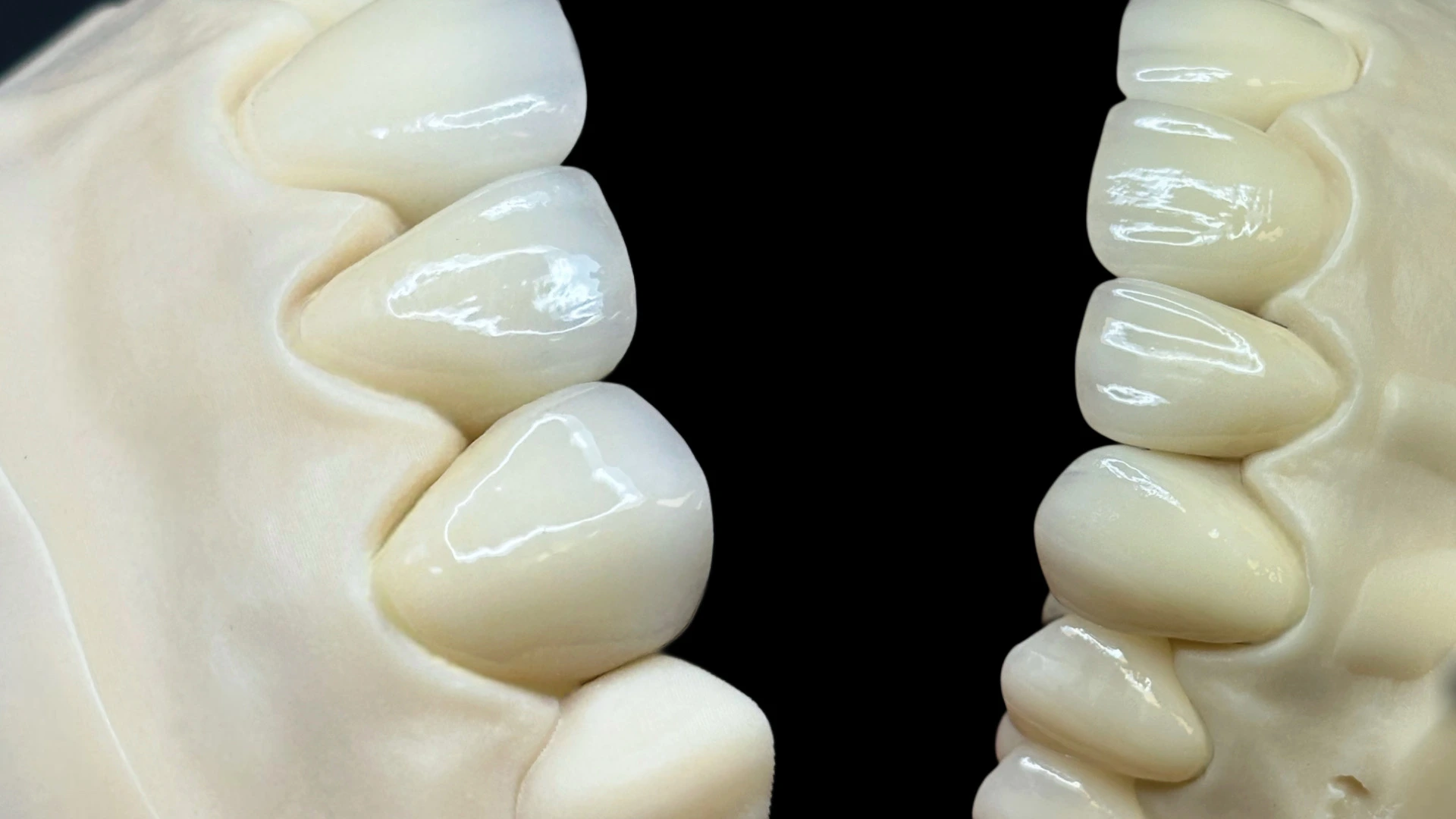 Безметалева кераміка