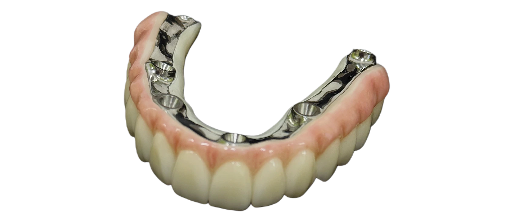 Ортопедичні конструкції на імплантах