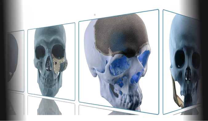 Індивідуальні пацієнтспецифічні рішення