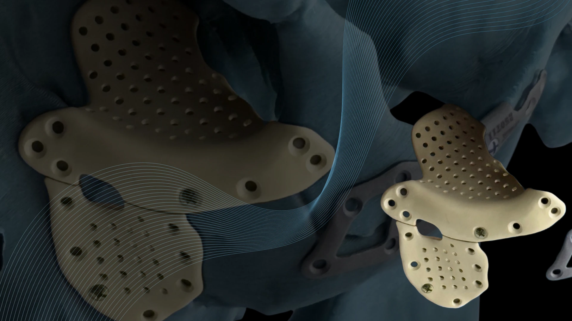 Реконструктивна  хірургія