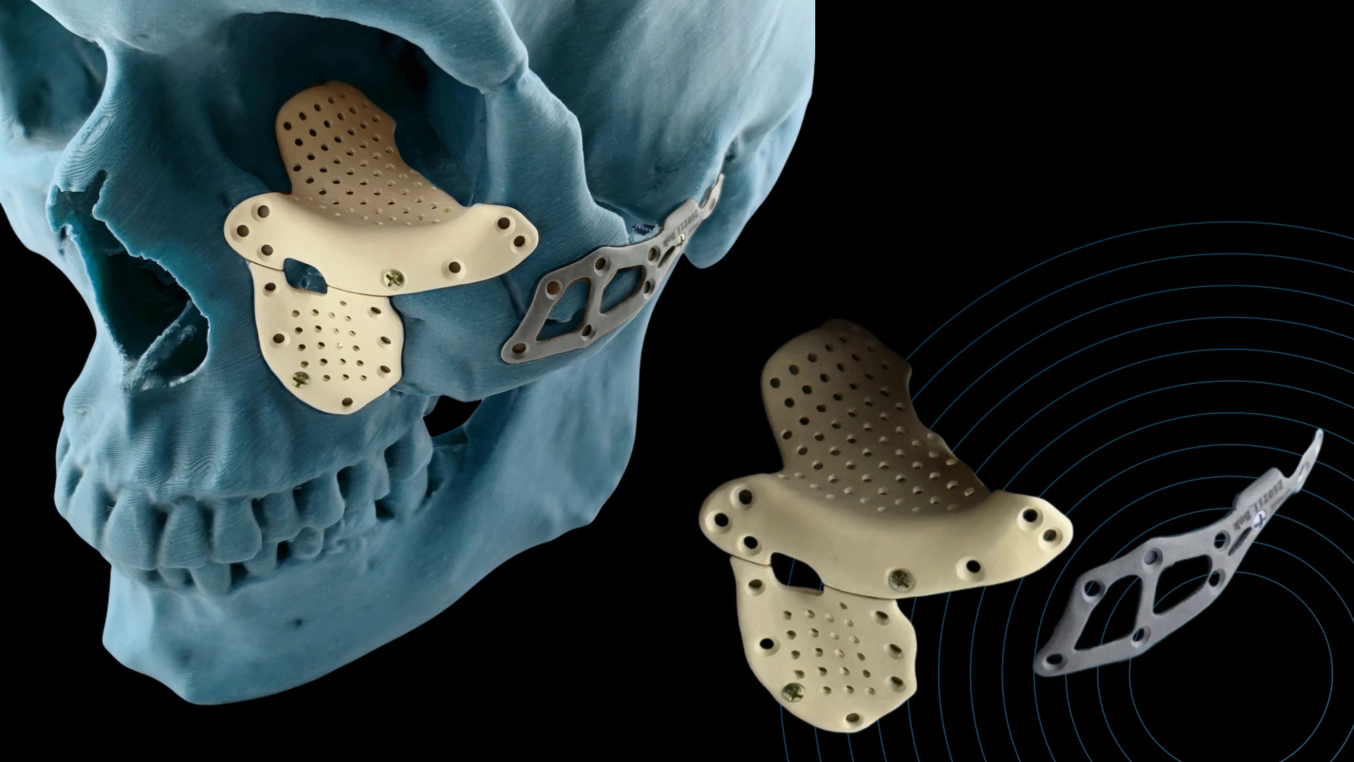 Скулоорбітальний  комплекс