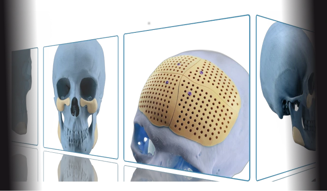 Пластична хірургія