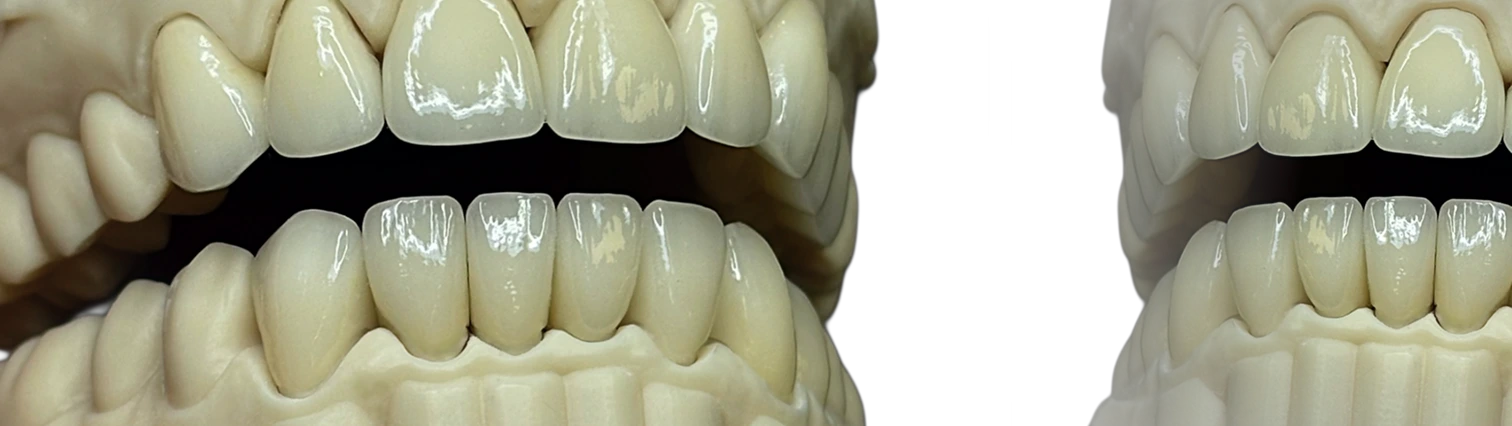 Безметалева кераміка